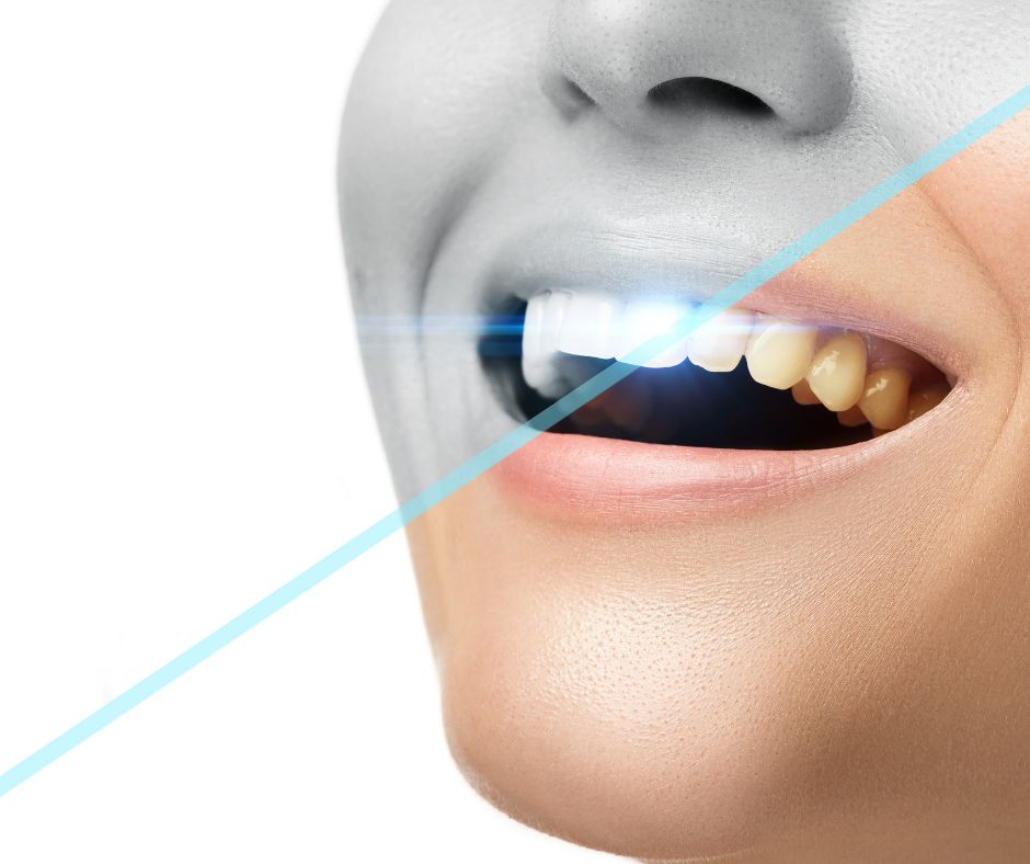 The Bright Path to Confidence: Understanding Professional Teeth Whitening